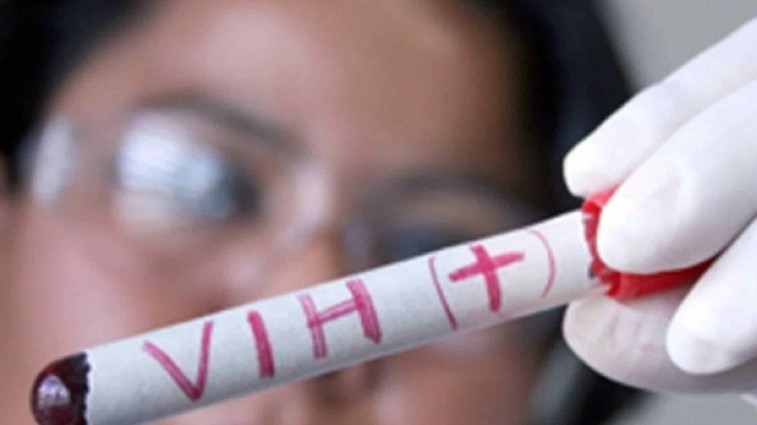 AUMENTAN LOS CASOS DE VIH EN YUCATÁN Y ALERTAN CAMBIOS EN LOS PATRONES DE CONTAGIO